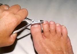 Toenail and Callus Debridement.jpg