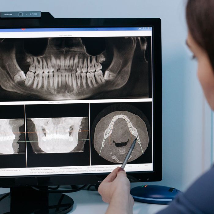 dentist reviews xrays dentist reviews xrays