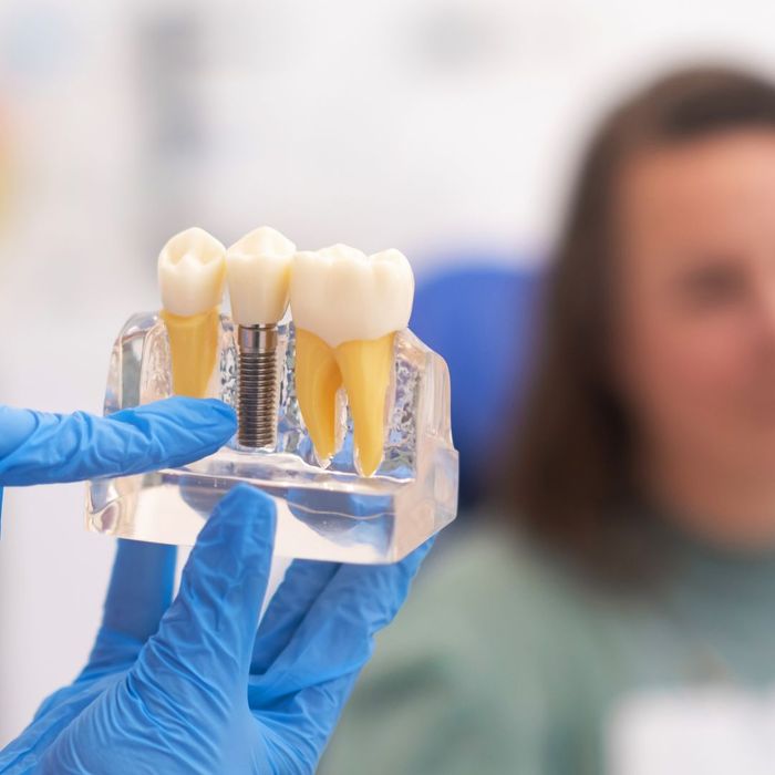 person wearing gloves points at mockup display of a dental implant How Dental Implants Can Improve Your Quality of Life 3.jpg