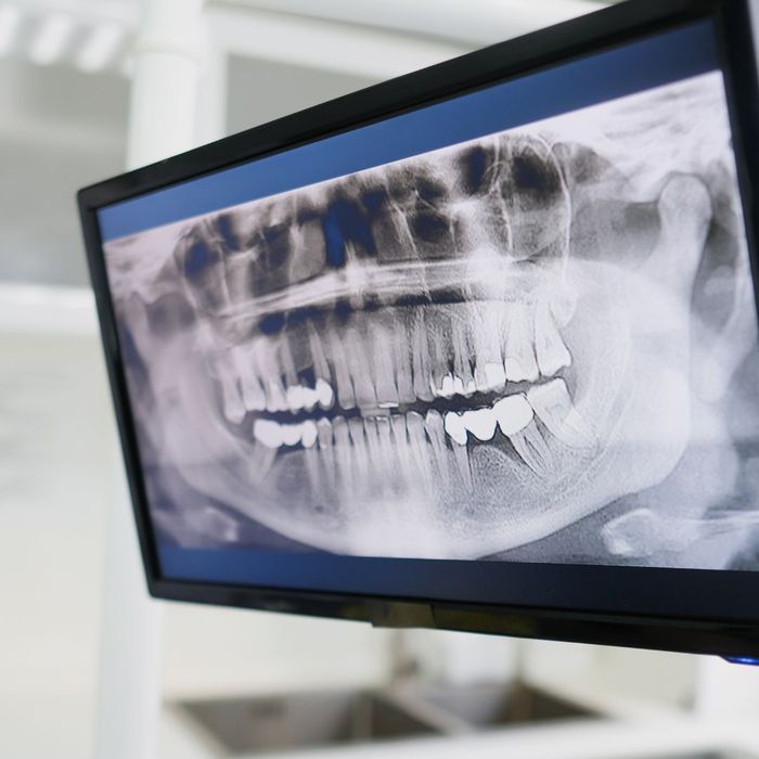 dental x ray dental x ray