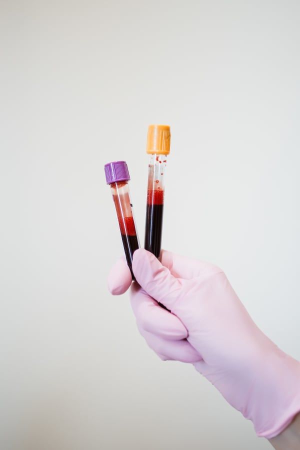 PRP/PRF Injections near me at she aesthetics medical spa in klein, spring, tomball, the woodlands, cypress, and houston tx. PRP can be used for joint rejuvenation, facials, hair restoration, and be used as filler