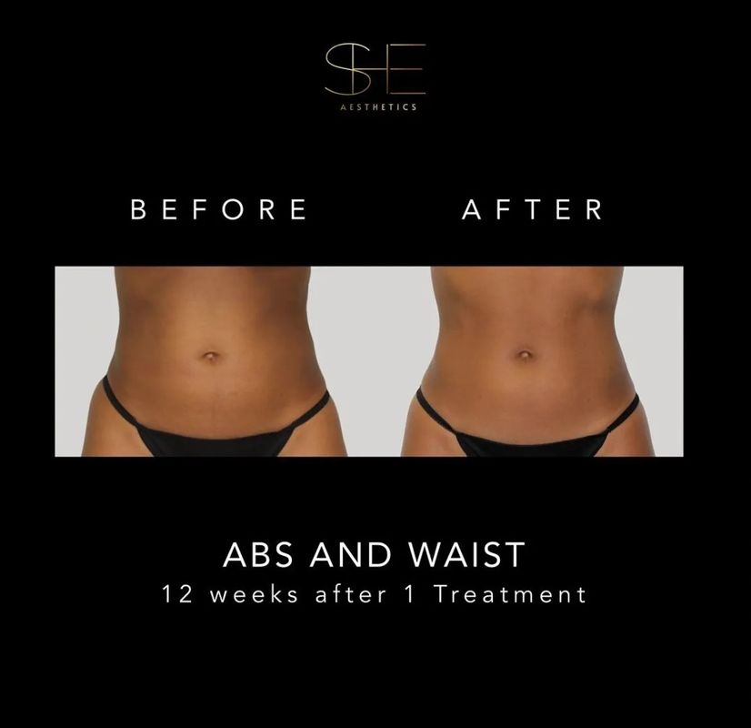 before and after abs and waist