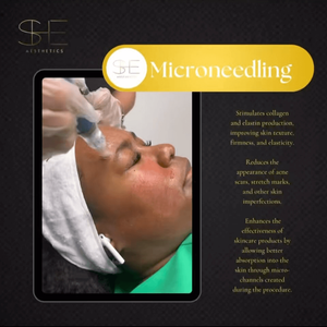 Instagram post about Microneedling