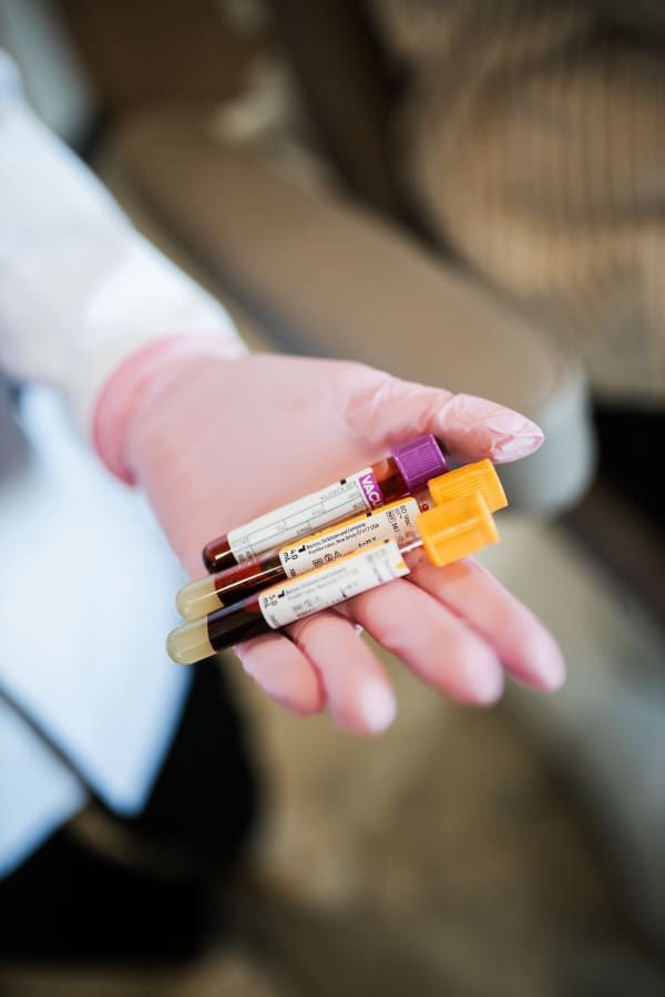 PRP/PRF Injections near me at she aesthetics medical spa in klein, spring, tomball, the woodlands, cypress, and houston tx. PRP can be used for joint rejuvenation, facials, hair restoration, and be used as filler