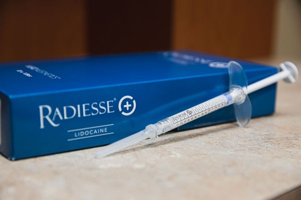 Radiesse near me in klein, spring, the woodlands, cypress and houston tx at she aesthetics medical spa 