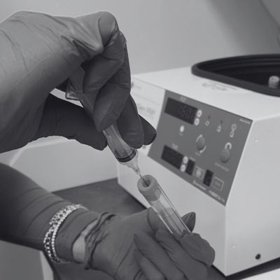 Prp treatments, prf treatments at she aesthetics in klein, spring, tomball, cypress, the woodlands tx Prp treatments, prf treatments at she aesthetics in klein, spring, tomball, cypress, the woodlands tx