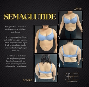 Instagram post about Semaglutide