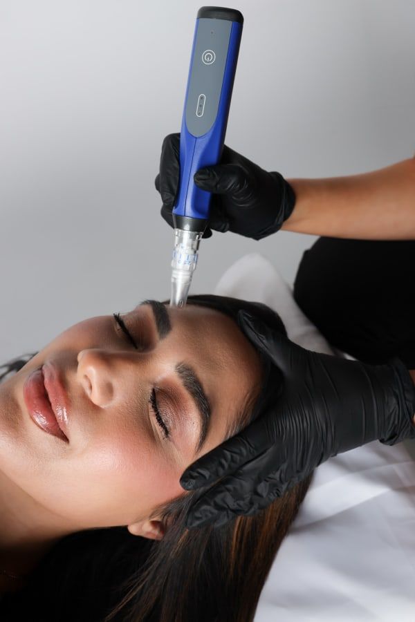 Microneedling near me in klein, spring, tomball, the woodlands, cypress, houston tx at she aesthetics 