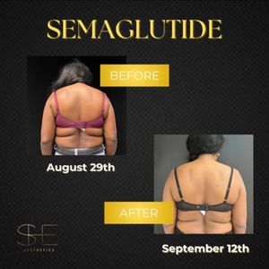 Instagram post about Semaglutide