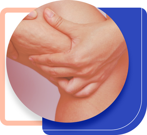 Cellulite.png