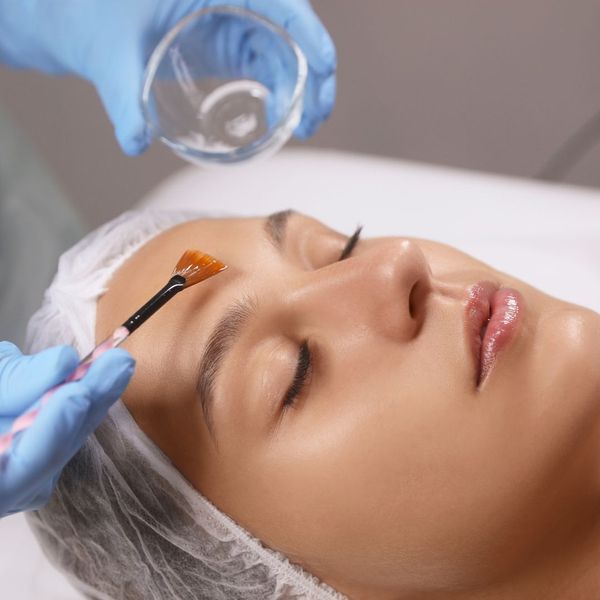 Person about to get a chemical peel
