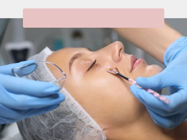 woman receiving Chemical Peel