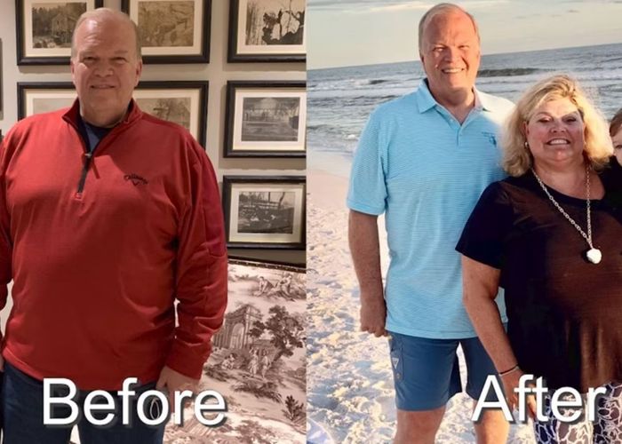 before and after photo 1