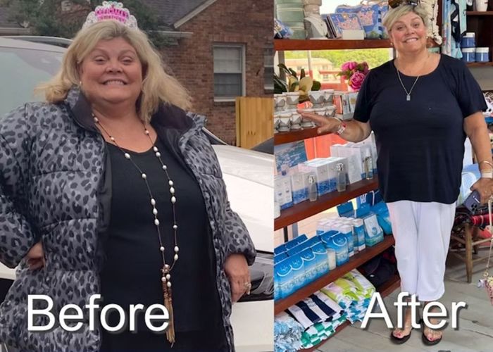 before and after photo 2