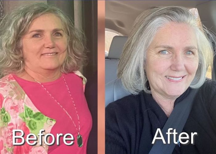 before and after photo 4