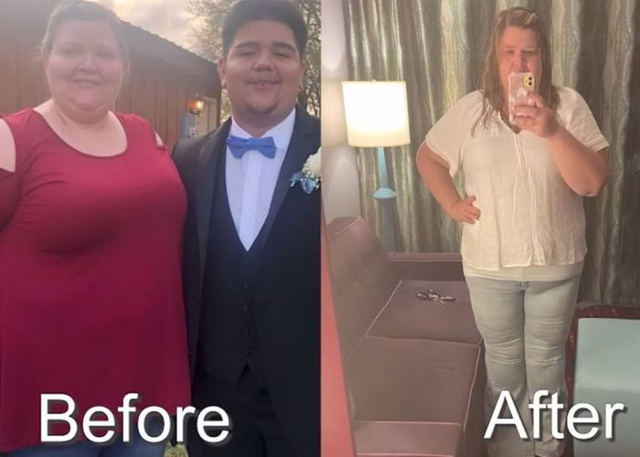 before and after photo 3