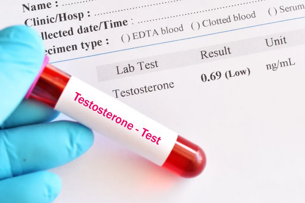 image of a testosterone test