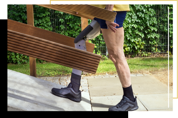 A person with a prosthetic leg