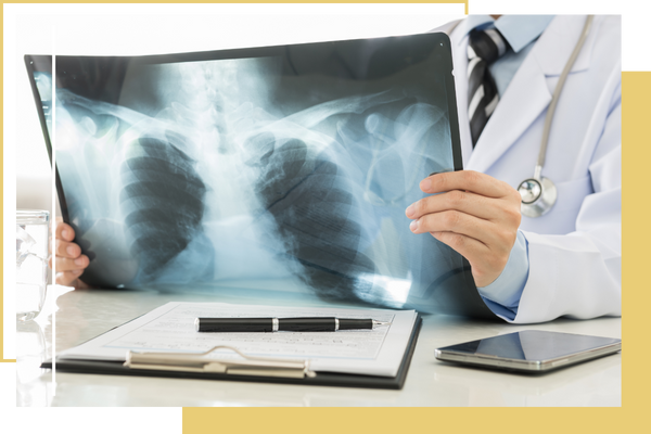 X ray being examined