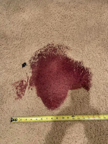 Tackling tough stains like coffee, wine, grease, and food spills, especially from high-traffic areas. Stain Removal