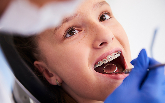 image of a girl with braces