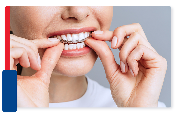 image of a woman putting in Invisalign