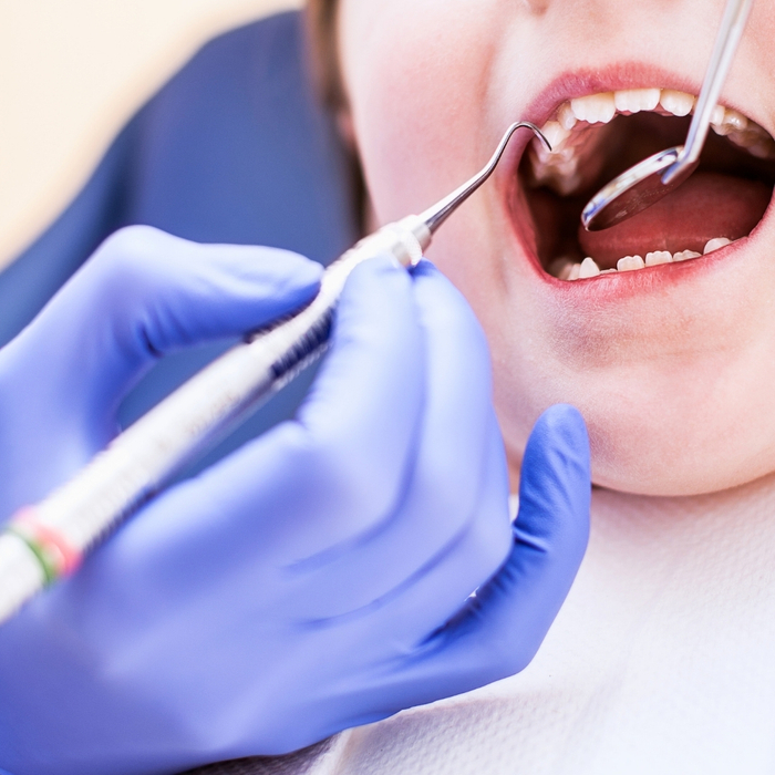 Tips to Help Quell Your Child's Fear of the Dentist-2.jpg