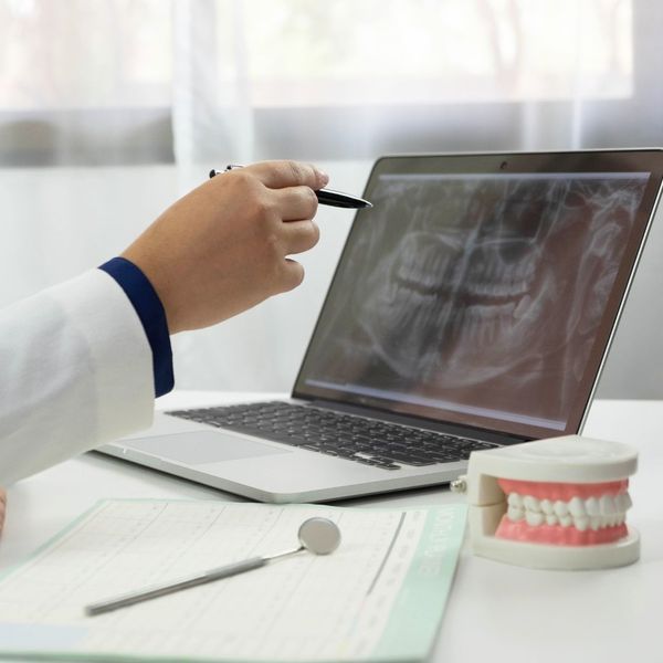 What Is Laser Periodontal Surgery.jpg