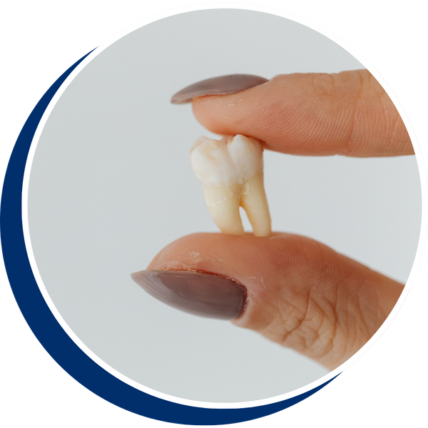 a person holding a tooth Emergency Dentistry Services Redesign.png