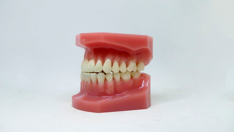 What Is Laser Periodontal Surgery Hero.jpg