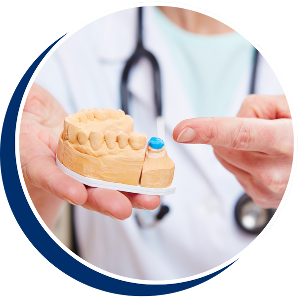 a crown on a model tooth General Dentistry Services Redesign (2).png