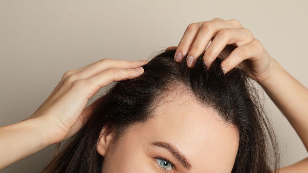 Elevate Your Confidence with Scalp Micro Pigmentation FeatImg.jpg