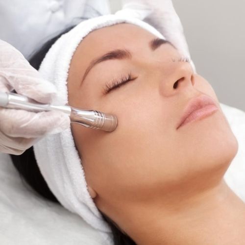 MICRODERMABRASION
