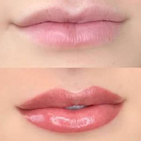 lips-5ea0ae0363314.jpg