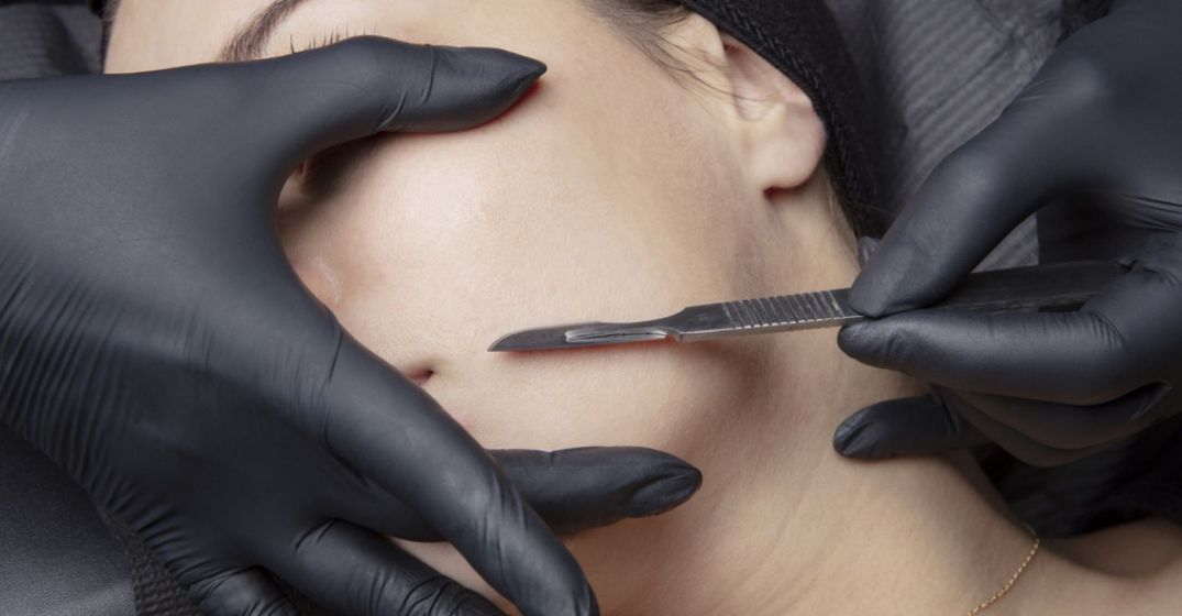 An image of a woman getting a dermaplaning treatment.