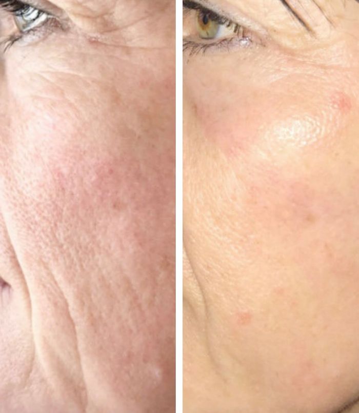 Screenshot 2024-11-03 at 7.41.05%E2%80%AFPM.jpeg