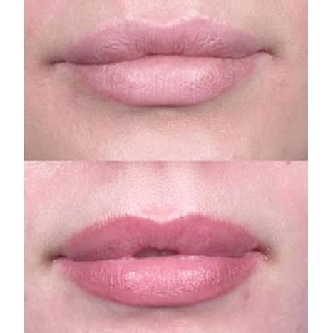 lips2-5ea0ae01cdfcb.jpg