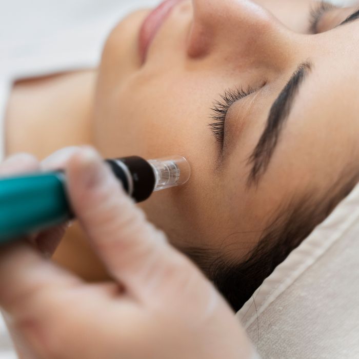 Image of Microneedling