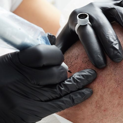 SCALP MICRO PIGMENTATION (SMP)