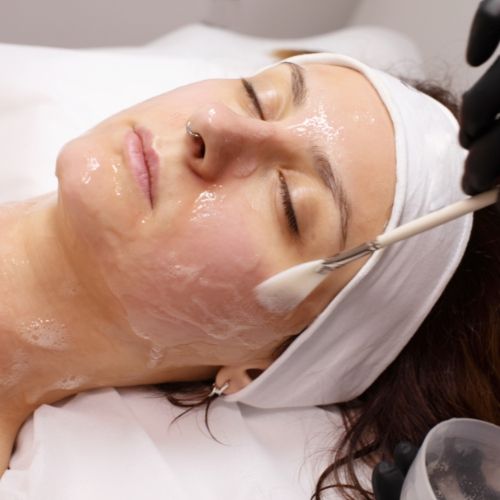 CHEMICAL PEELS