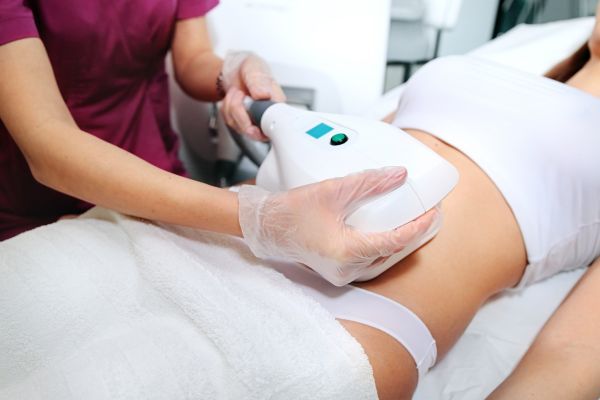 cryoskin slimming