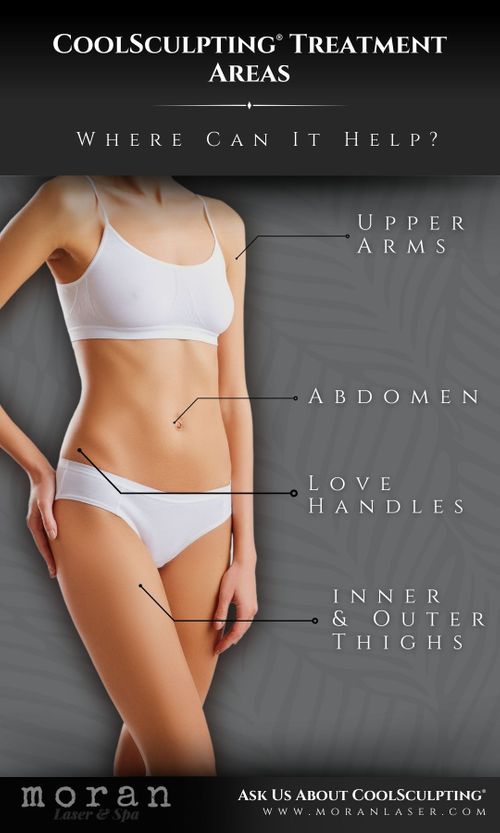 M24620 - Infographic - CoolSculpting Treatment Areas.jpg