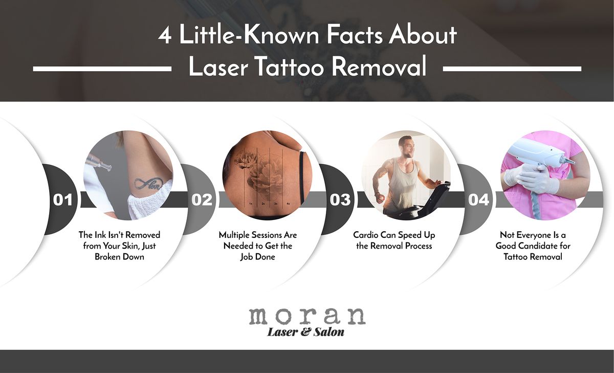 4-Tattoo-Removal-Facts-Moran-Laser-and-Salon-IG-01-6193fae7a84ff.jpg