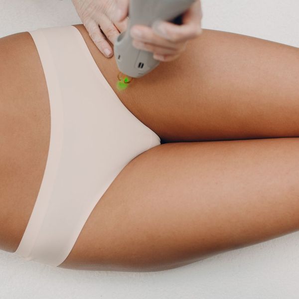laser hair removal around a woman's bikini line