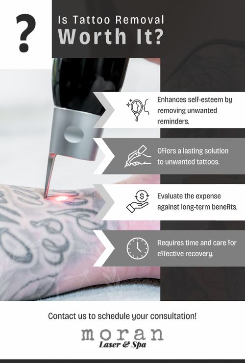 The Pros and Cons of Laser Tattoo Removal.jpg