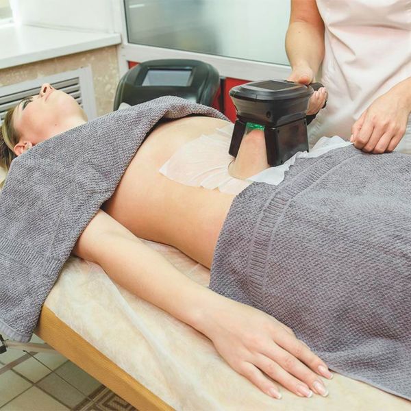 CoolSculpting process