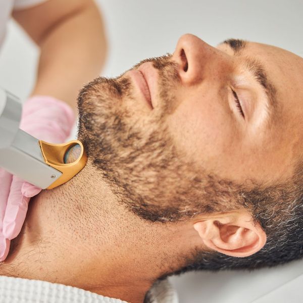 man getting laser hair removal under his chin