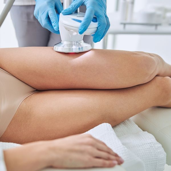 coolsculpting on leg