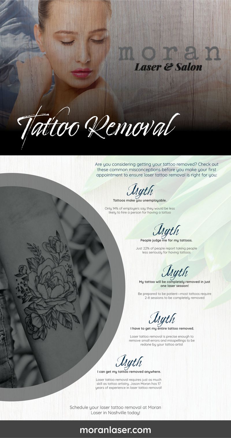 Laser Tattoo Removal FAQ | Goodbye Tattoos | Neutral Bay