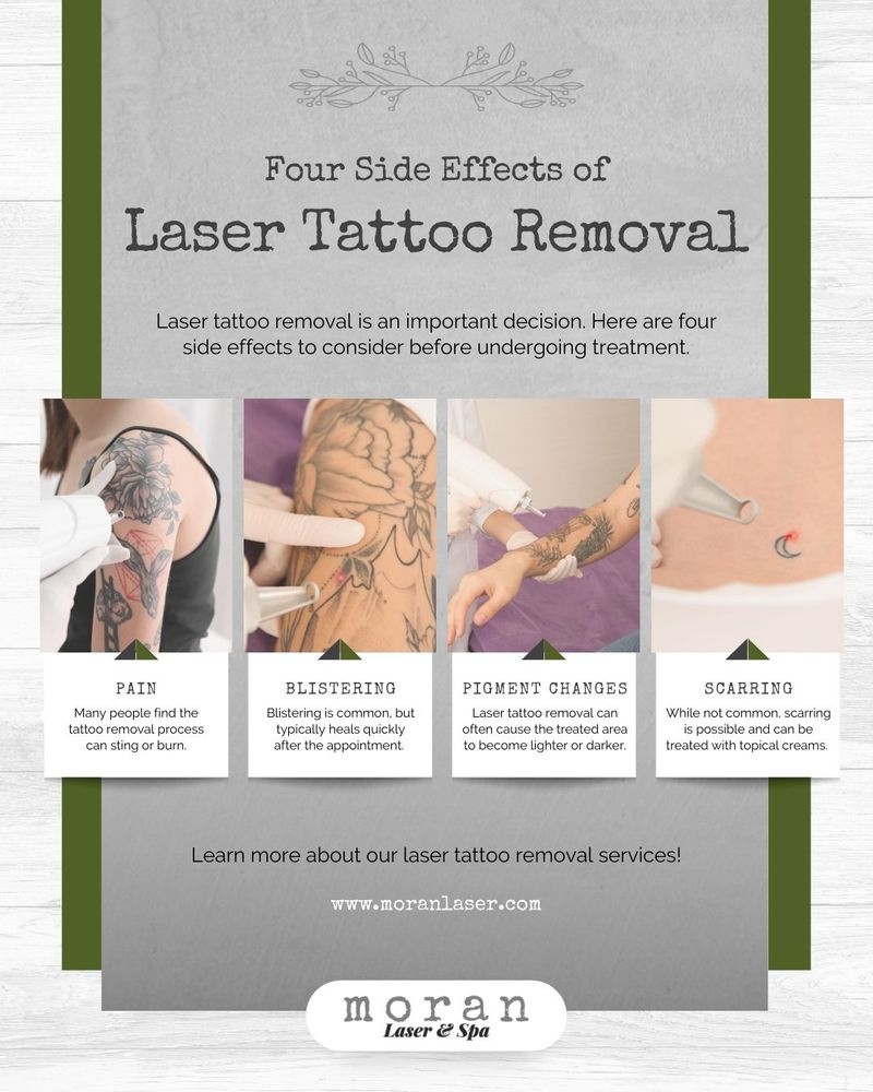 Four Side Effects of Laser Tattoo Removal infographic